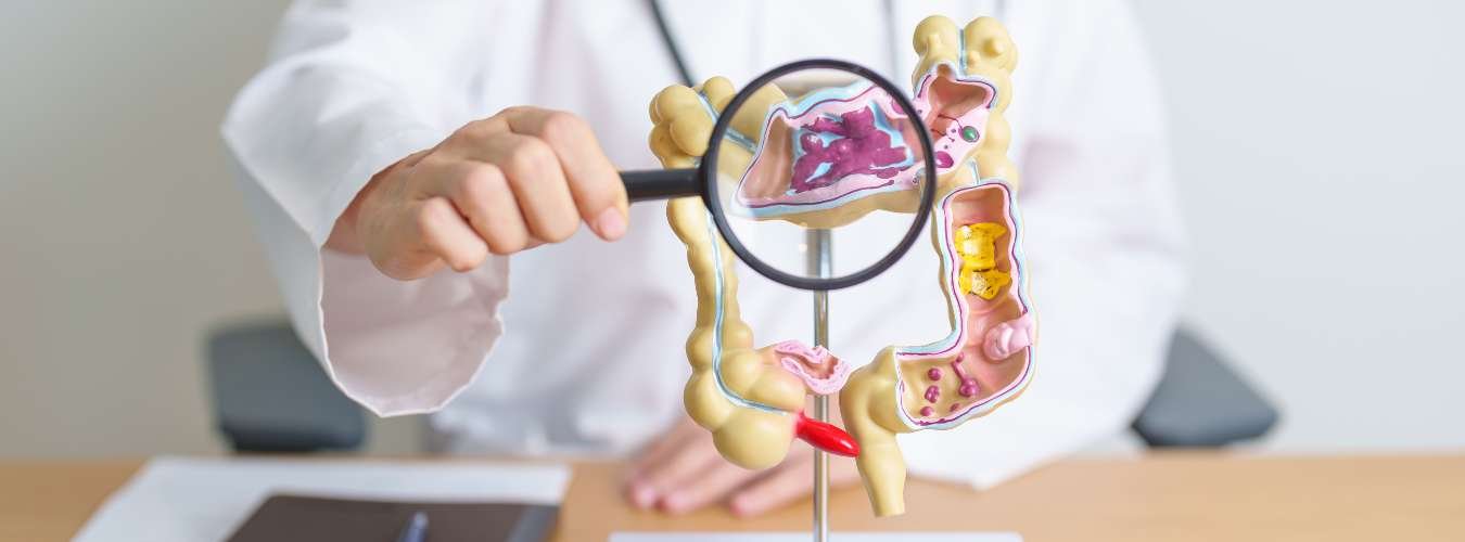 IBS treatment in Gurgaon