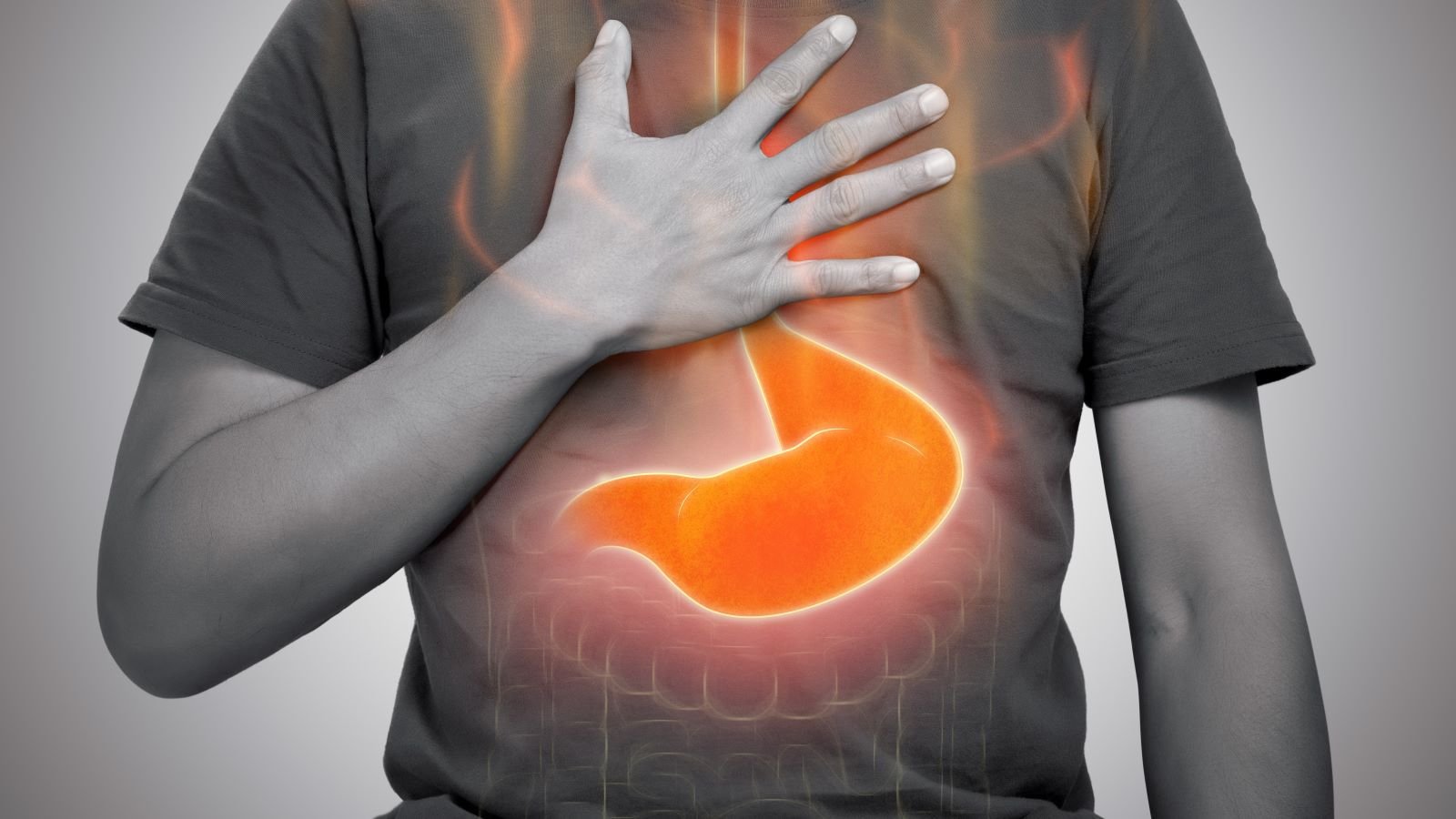 acid reflux treatment gurgaon