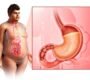 gas and acidity treatment 90x80