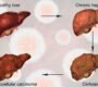 liver problems  90x80