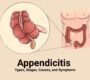 Appendicitis 90x80