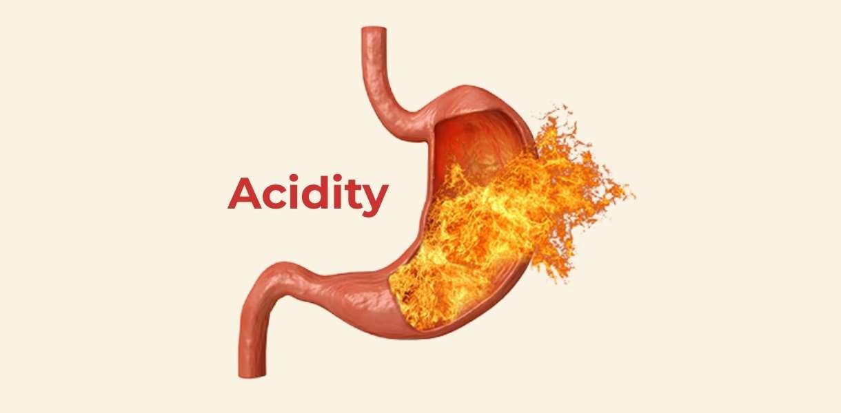 acidity prevention
