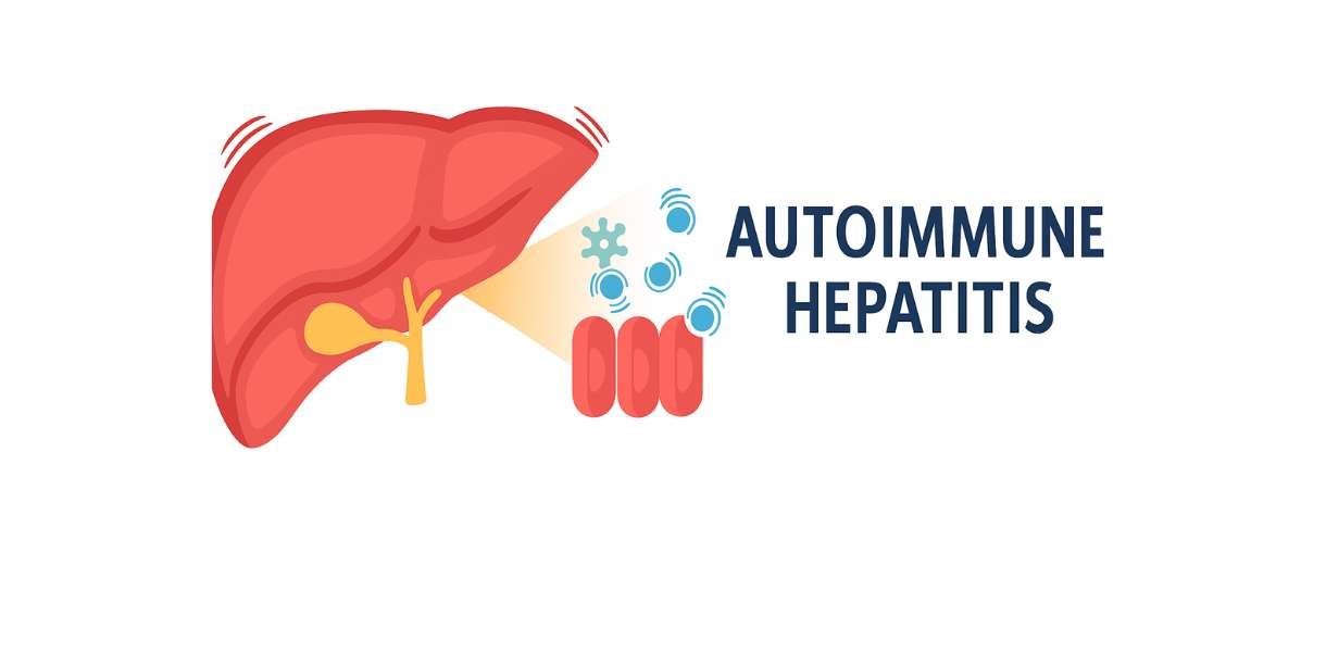 autoimmune hepatitis