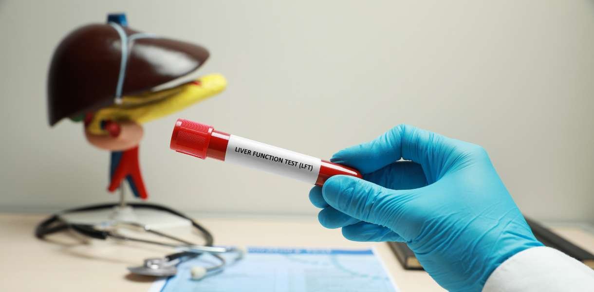 liver function test(LFT)