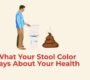 stool color indications 90x80