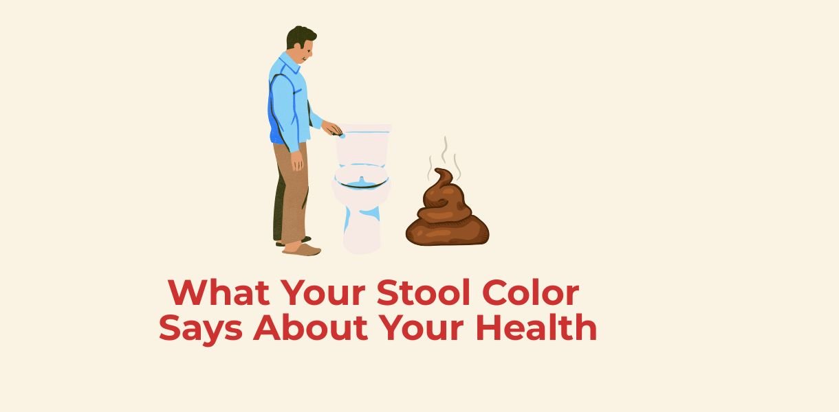 stool color indications