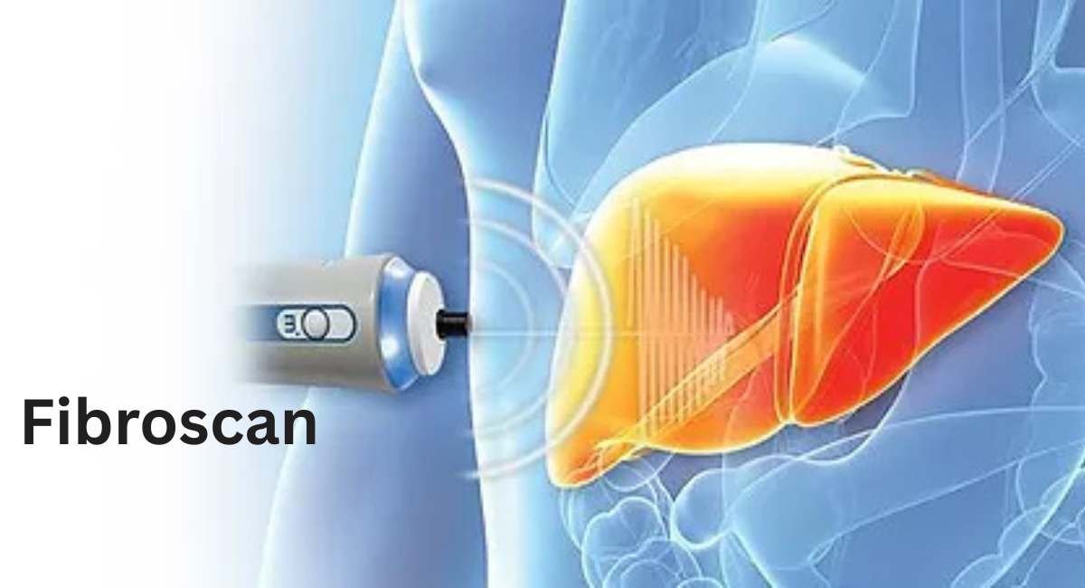 Fibroscan in Gurgaon
