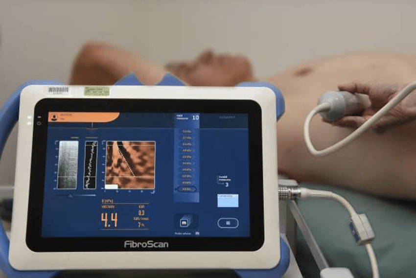 Fibroscan New Gurgaon