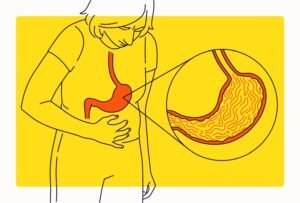 Common causes of abdominal pain