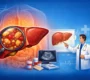 Liver Enlargement 90x80