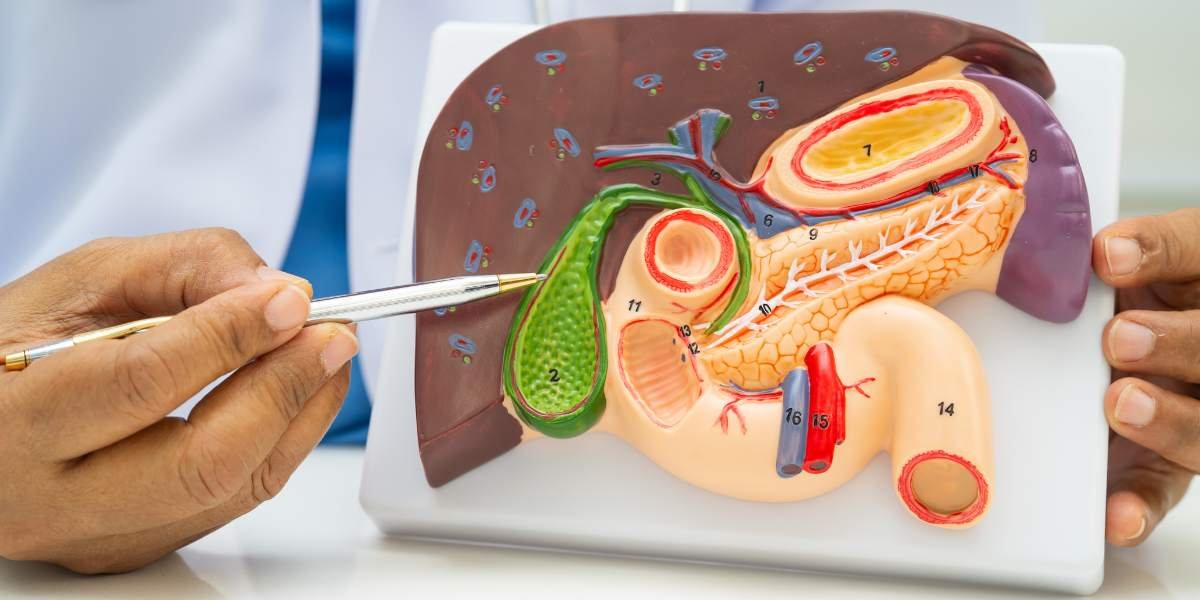 gallbladder stones prevention