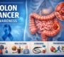 colon cancer 90x80