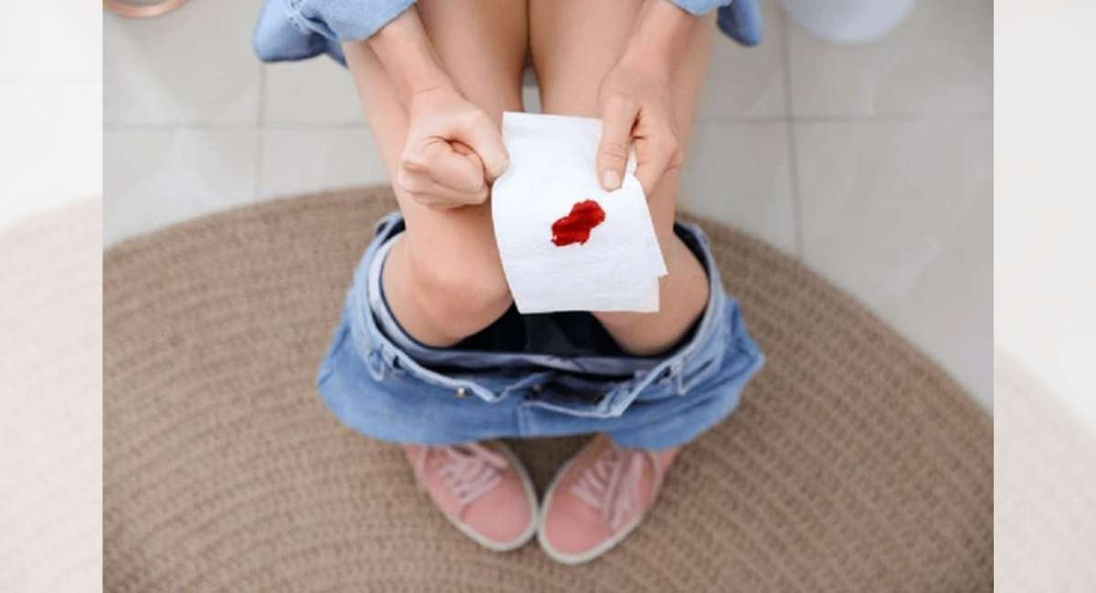 blood in stool