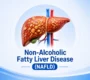non alcoholic fatty liver disease 90x80