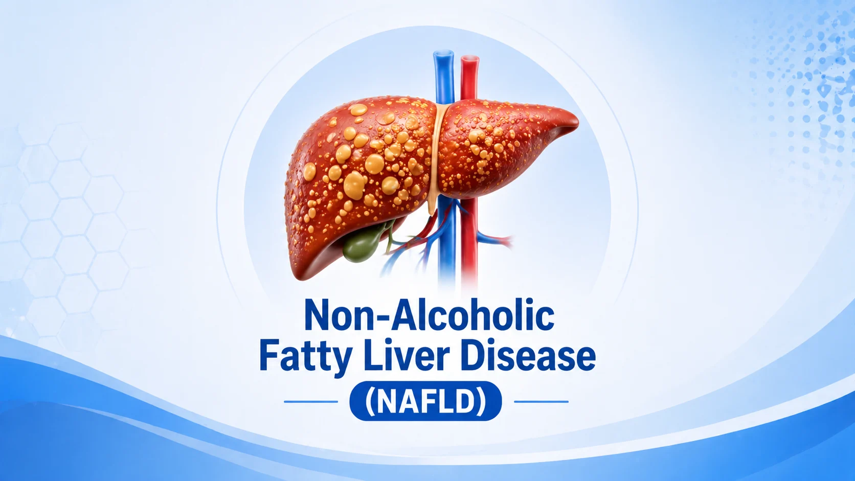 non alcoholic fatty liver disease