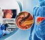 ERCP Treatment 90x80