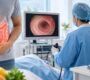 Colonoscopy 90x80
