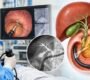 ERCP diagnosis 90x80