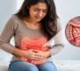 IBS treatment 90x80